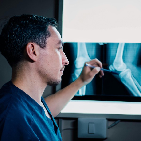 Un Product Specialist ortopedia guarda delle analisi ai raggi X